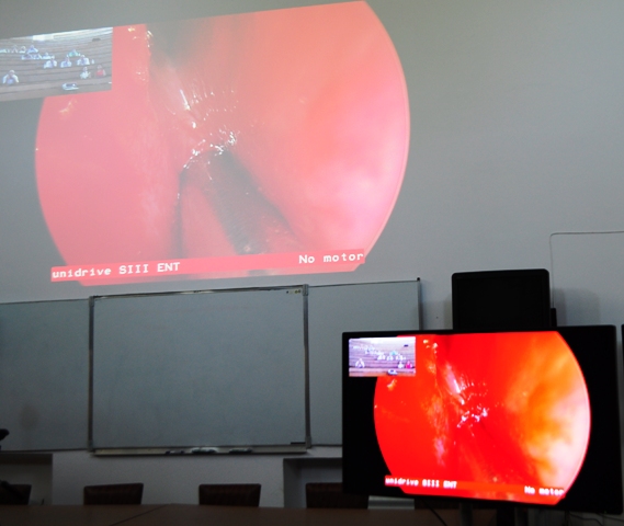 Работата на хирурзите можеше да се наблюдава на живо благодарение на видеовръзката от операционната 